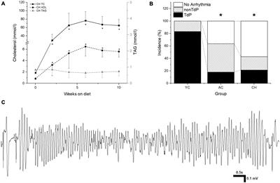 TdP Incidence in Methoxamine-Sensitized Rabbit Model Is Reduced With Age but Not Influenced by Hypercholesterolemia